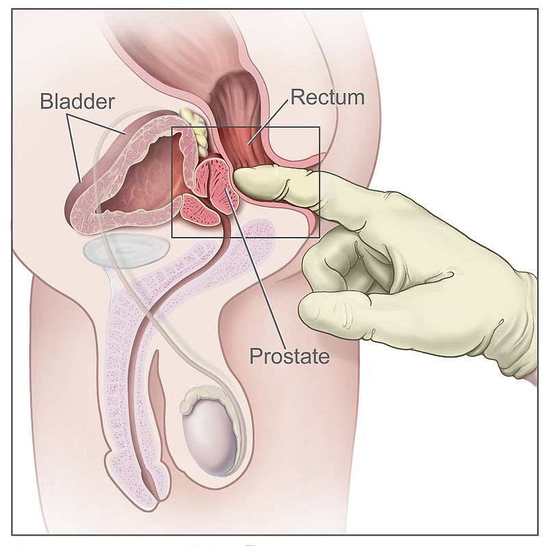 Prostate anatomy, How ot use best prostate massager, best prostate gland, best prostate massager for men,